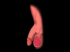 治疗阳痿早泄吃什么药? 治疗阳痿早泄吃什么药?