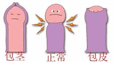 河池男性包皮包茎的严重危害是什么 河池男性包皮包茎的严重危害是什么