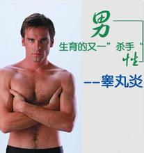 河池男性睾丸肿胀如何治疗? 河池男性睾丸肿胀如何治疗?